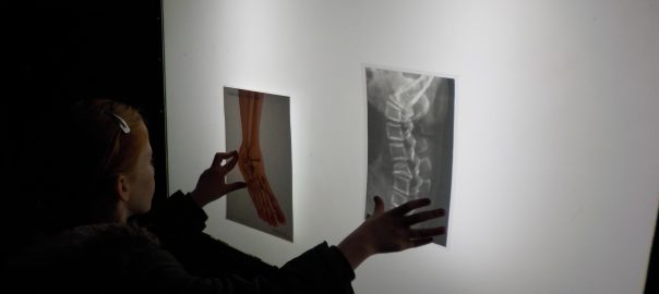 Finding out about X-Rays at Thackray Medical Museum